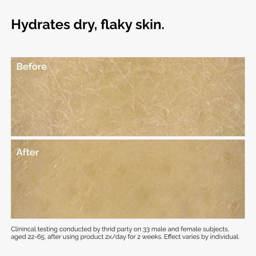 the-body-care-collection-t8 ord-natural-moisturizing-factors-inulin-body-before-after-graphic-02.jpg