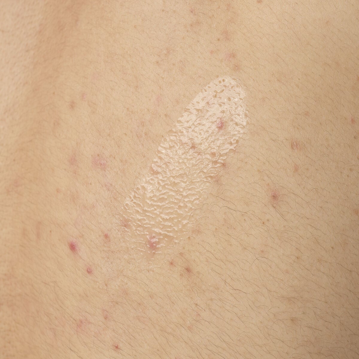salicylic-acid-0-5-body-serum-z9 ORD-salicylic-acid-05-body-240ml-application.jpg