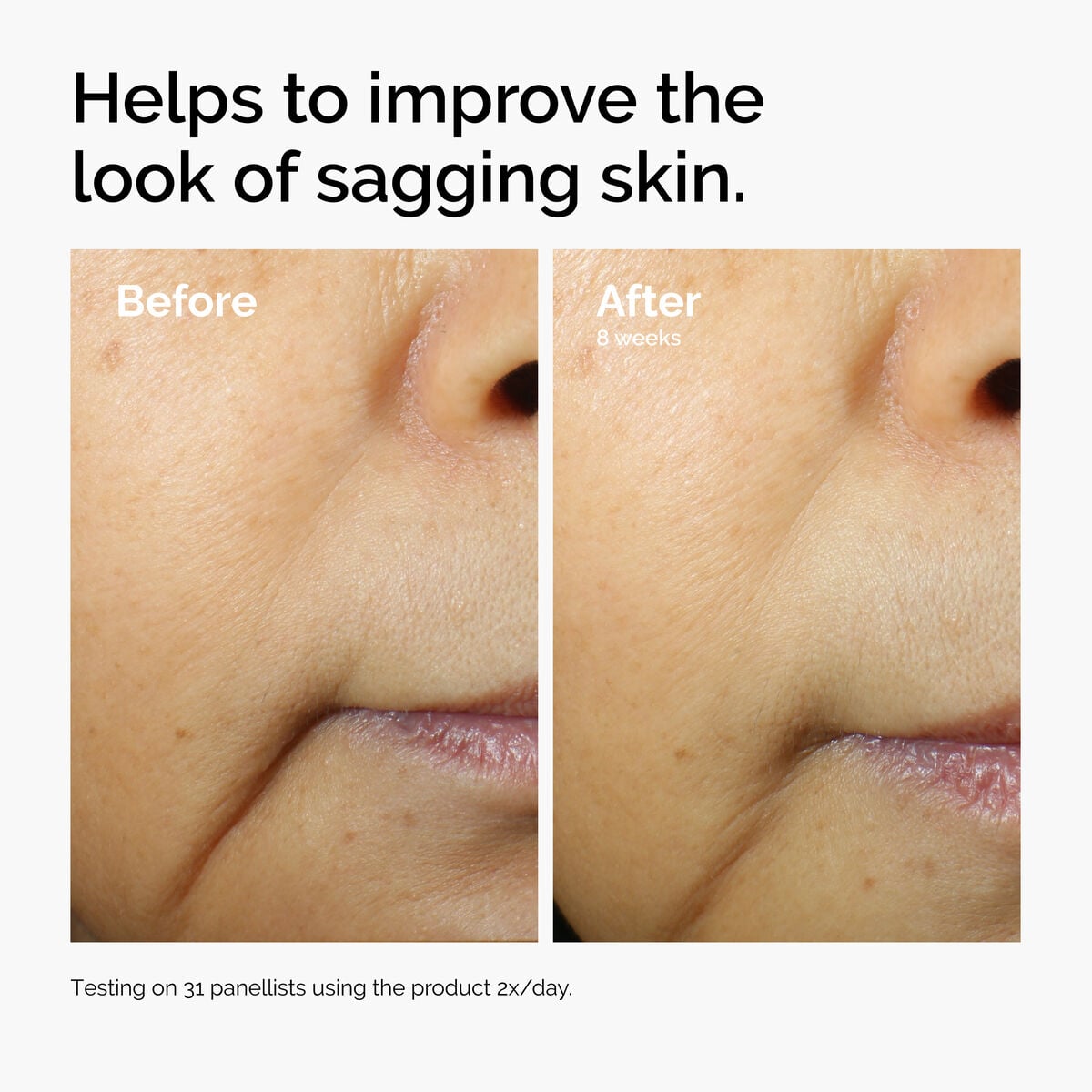 caffeine-3-escin-1-face-serum-q7 ord-caffeine-3pct-escin-1pct-face-serum-before-after-sagging.jpg