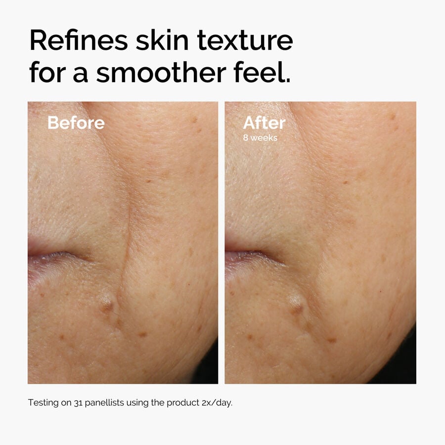 caffeine-3-escin-1-face-serum-q7 ord-caffeine-3pct-escin-1pct-face-serum-before-after-texture.jpg