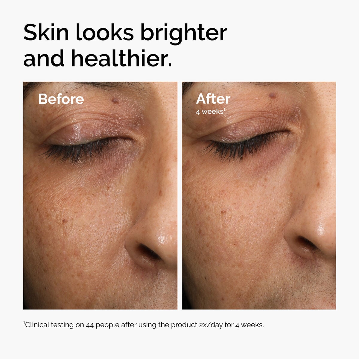 multi-antioxidant-radiance-serum-q4 ord-mars-before-after-healthy.jpg