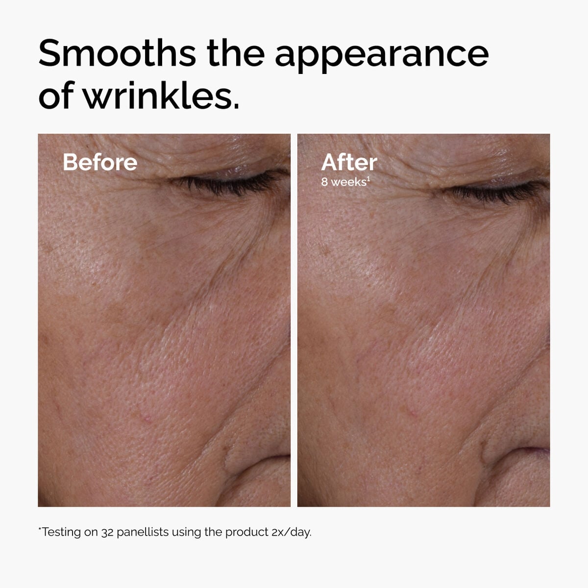 multi-peptide-ha-serum-h7 ord-multi-peptide-ha-serum-wrinkles-before-after.jpg