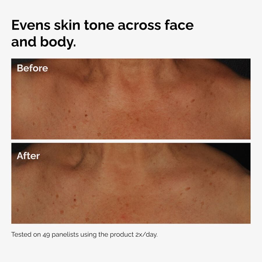 the-body-care-collection-t8 ord-niacinamide-face-body-serum-before-after-even-tone-graphic.jpg