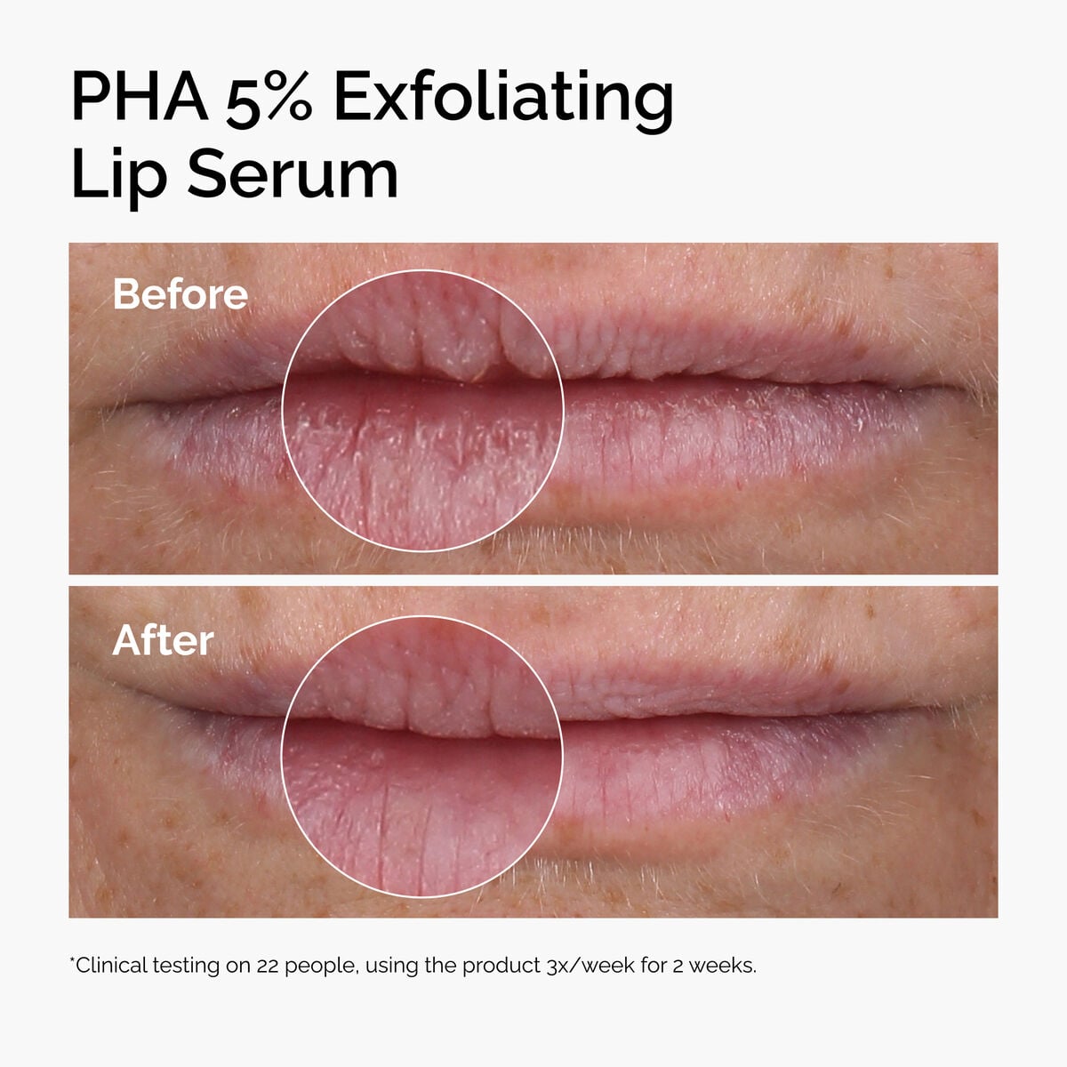 pha-5-exfoliating-lip-serum-j4 ord-pha-5pct-lip-exfoliating-serum-before-after.jpg