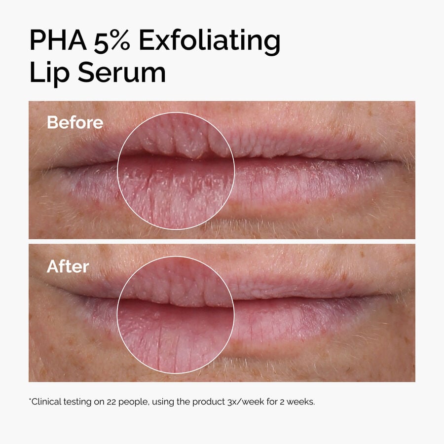 pha-5-exfoliating-lip-serum-j4 ord-pha-5pct-lip-exfoliating-serum-before-after.jpg